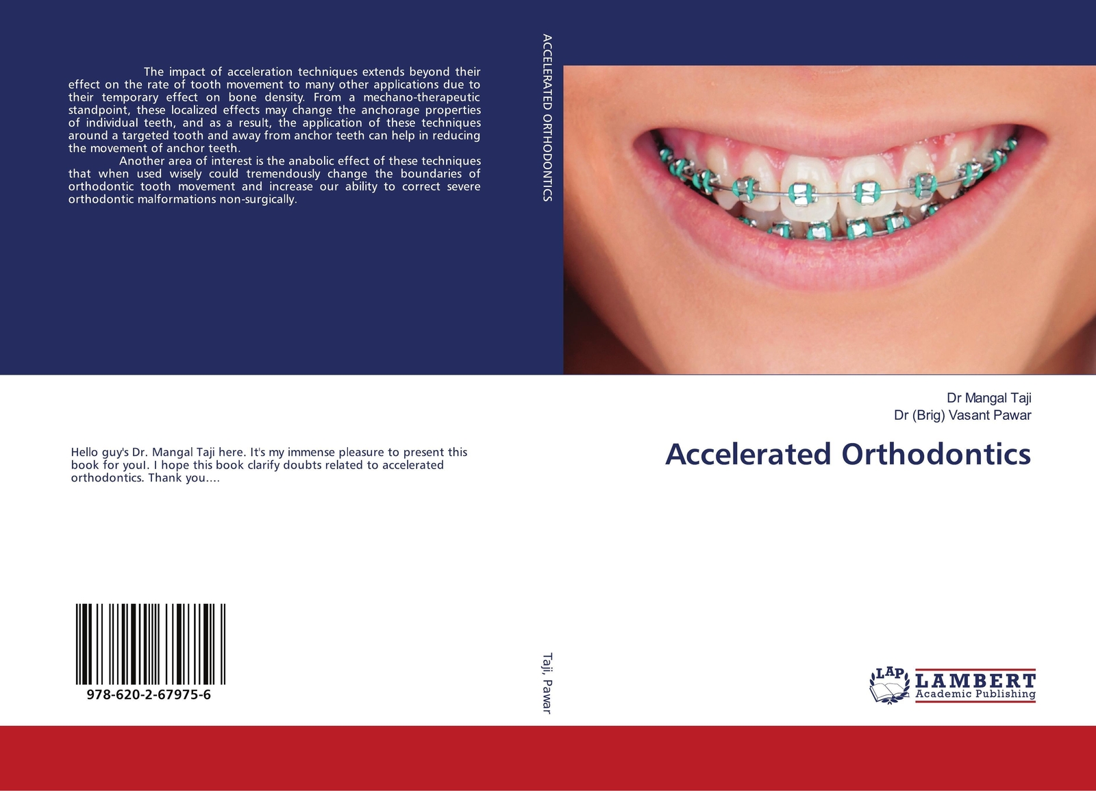 Thumbnail - Mangal Taji (u. A.) | Accelerated Orthodontics | Taschenbuch |