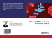 Yahya Al-Haideri (U. A.) | The Use Of Prp To Accelerate Skin Wound Healing