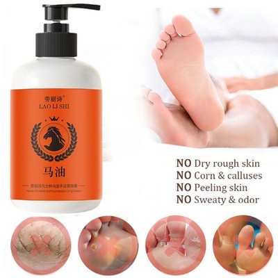 +Pferdeöl|Hand- und Fußfeuchtigkeitscreme| Feuchtigkeitsspendende Handlotion-300g- Körper O2I6