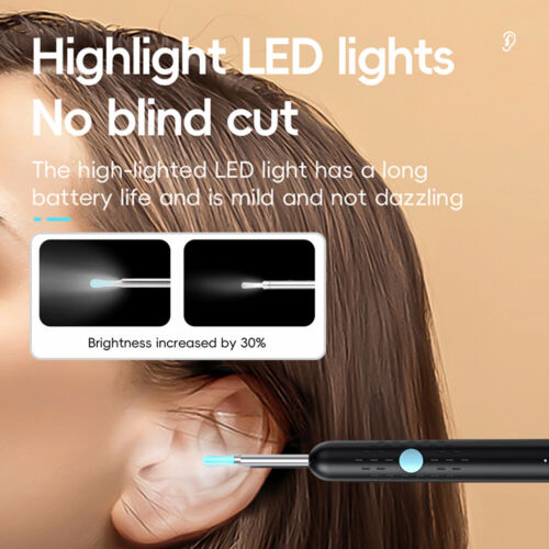 Smart Ear Wax Removal Cleaner Wireless Visual Endoscope Spoon Otoscope Camera - Picture 8 of 23