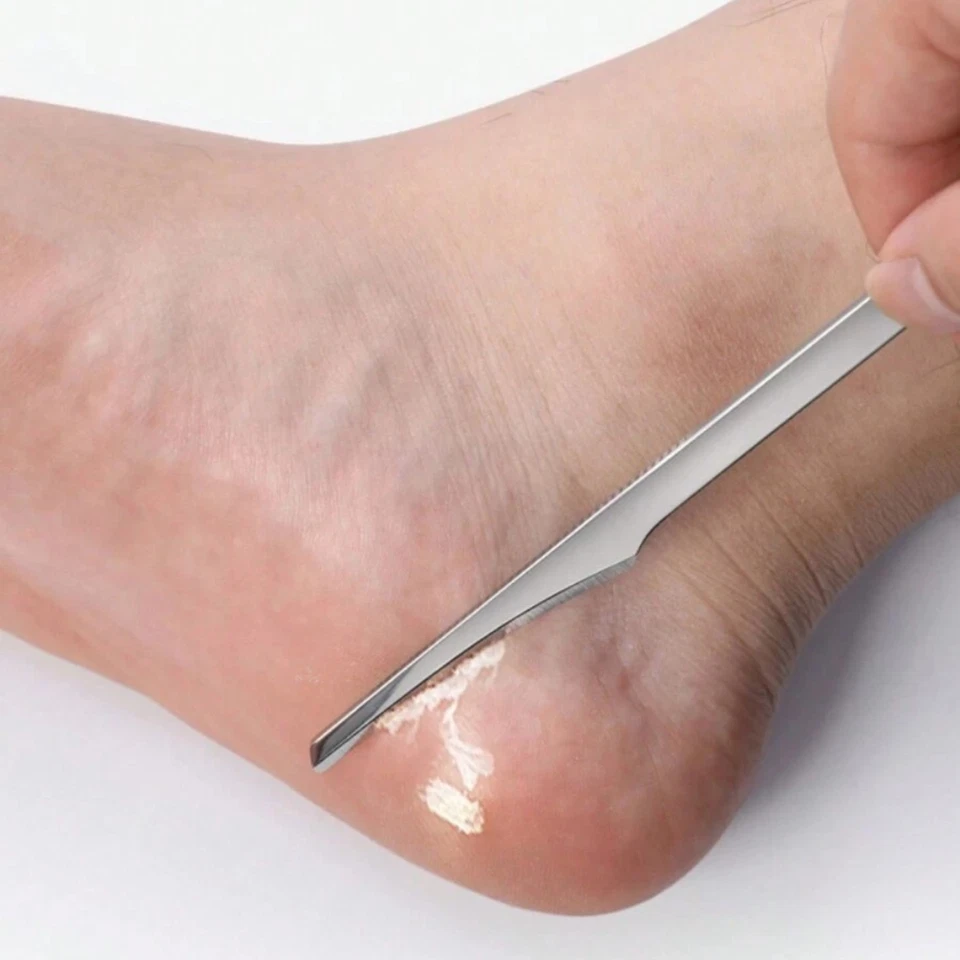 1set Foot Callus Remover - Exfoliating Scraper for Dead Skin & Daily Foot Care - Image 2 of 4