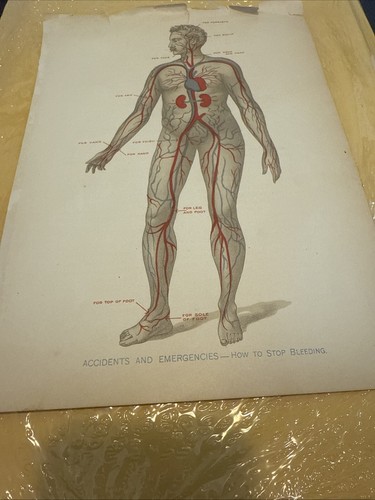 1916 E J Stanley ANTIQUE MEDICAL Anatomy Chart Accidents And Emergencies 9.75x7