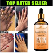 Skin Whitening Serum for Removing Dark Knuckle from Hand  Knee - 30 ml FS