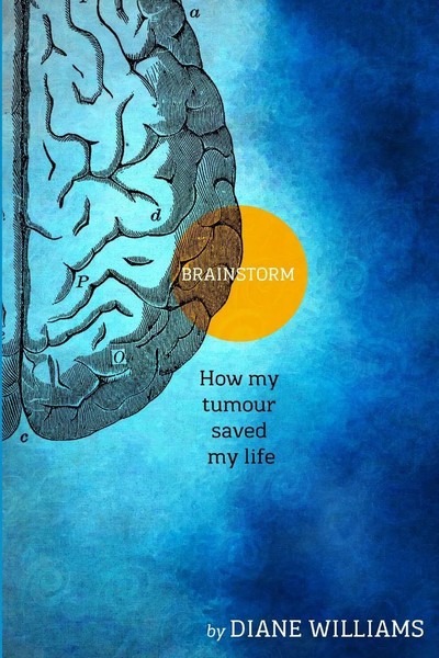 Diane Williams | Brainstorm How My Tumour Saved My Life | Taschenbuch | Englisch-image