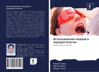 Anshul Sonni (U. A.) | Ispol'zowanie Lazerow W Parodontologii | Taschenbuch