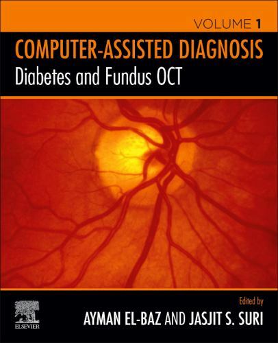 Diabetes and Fundus OCT S. El-Baz Suri Paperback Elsevier 9780128174401
