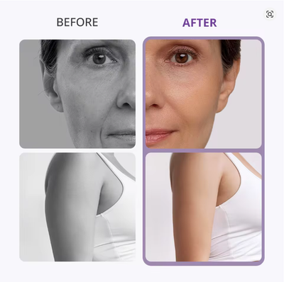 8 in 1 RF Premium Ultrasonic Facial Body Beauty Machine Spa Salon