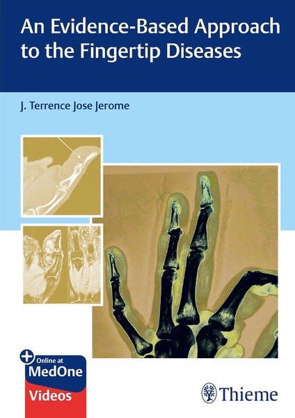 J Terrence Jerome | An Evidence-Based Approach To The Fingertip Diseases | Buch-image