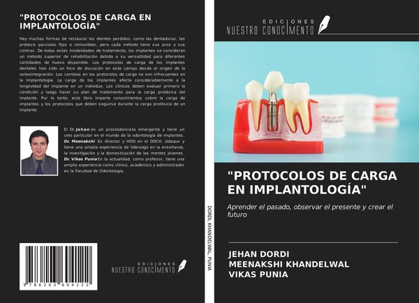 "\"Protocolos DE Carga EN ImplantologÍA\" Meenakshi Khandelwal"-image
