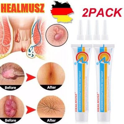 2x Hämorrhoiden Salbe Antibakterielle Hämorrhoidencreme Linderung der Schmerzen