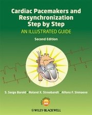 Cardiac Pacemakers and Resynchronization Step...