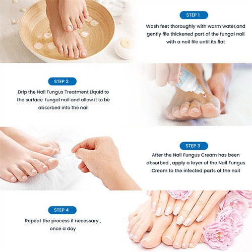 20ML Anti Fungal Nail Treatment For Nail Finger Toe Fungus Onychomycosis Deal - Picture 7 of 11