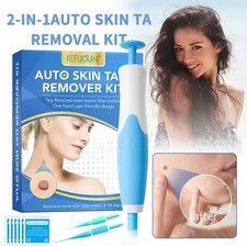 Auto Micro Skin Tag Remover Device Kit Safe Painless Removal 2-8 mm Band Tool