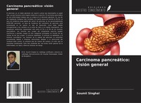 Carcinoma PancreáTico: VisióN General Soumil Singhal