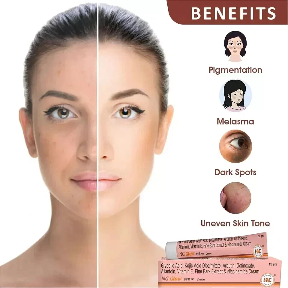 3X Heal n Cure NG Glow Cream 20g For Melasma, Pigmentation, Acne Scar, Dark Spot - Image 2 of 4