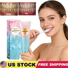 Niacinamide Whitening Toothpaste,Natural Niacinamide Toothpaste,Teeth Whitening