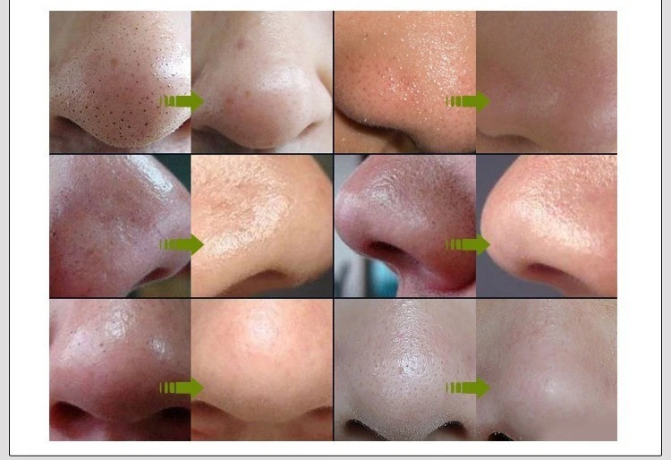 净化黑色 BAMBOO CHARCOAL PEEL-OFF 面部清洁去黑头 — 第 3/4 张图片