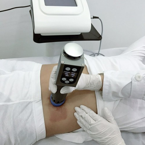 Home Spa Use 5-200 MJ Shock Wave Therapy Shockwave Body Pain Relief Machine - 第 7/12 張圖片