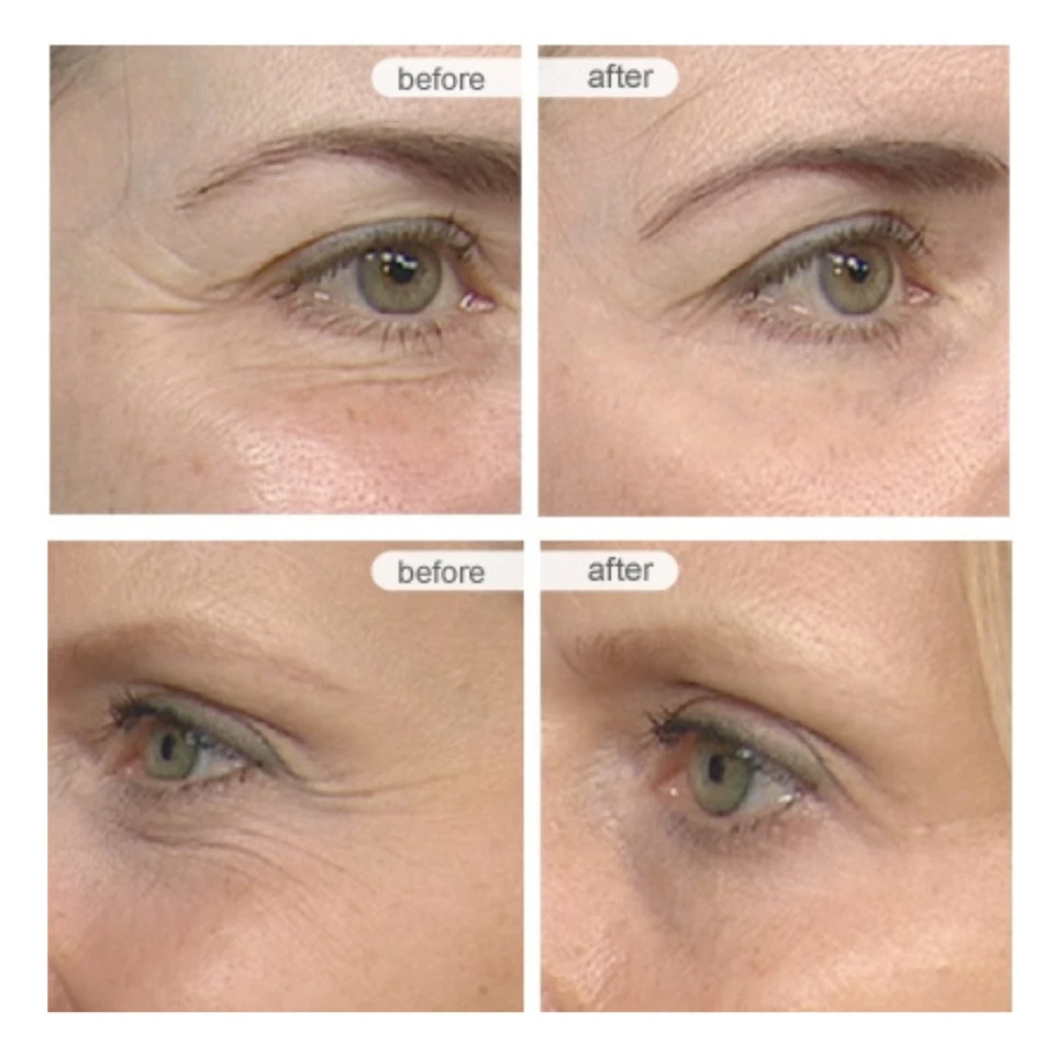 Matrixyl 3000, Argireline, Vitamin C Hyaluronic Acid Peptide Wrinkle SERUM - 4oz - Image 3 of 4