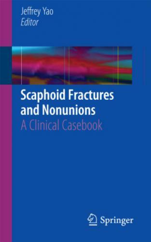 Thumbnail - Scaphoid Fractures And Nonunions A Clinical Casebook 2899