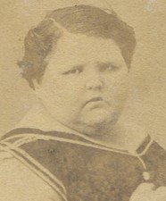 CIRCUS SIDESHOW FREAK, FAT CHILD. CDV.
