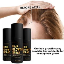 HaloGrow Hair Growth Spray 50ml Natural Hair ...