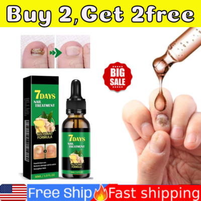 Ginger Nail-Treatment Nail-Care, Nail-Growth Oil for Cuticle Nourishment NEW