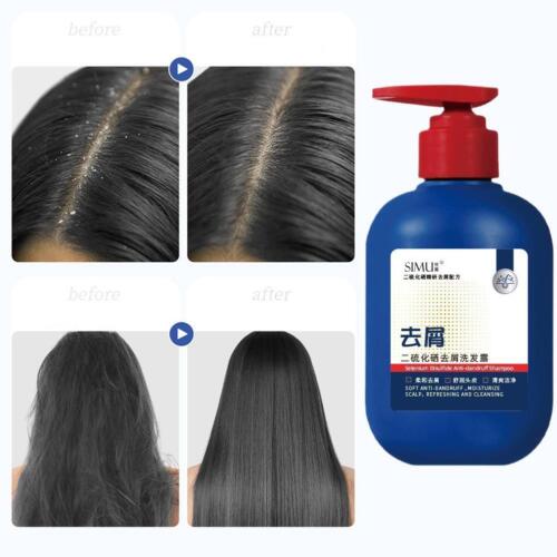 Anti Dandruff Shampoo 300ml Dry Scalp Selenium sulfide anti-dandruff shamp C8M7 - Picture 4 of 11