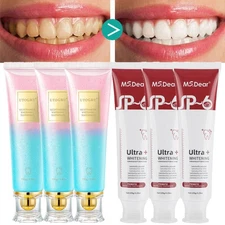 Niacinamide Whitening Toothpaste,Probiotic Whitening Toothpaste,Teeth Whitening