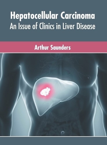 Hepatocellular Carcinoma: An Issue of Clinics in Liver Diseas (Copertina rigida)