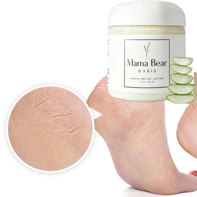  Mama Bear 绿洲保湿乳液足腿舒适,氯化镁 4 盎司  — 第 3/4 张图片