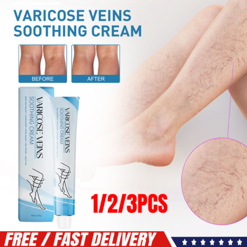 1/2/3X Varicose Veins Cream Varicose Veins Treatment Cream For Legs - Picture 1 of 13