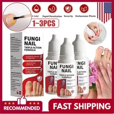 Fungi-Nail Anti-Fungal Liquid Solution Kills Fungus That Can Lead To Nail