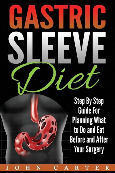 Gastric Sleeve Diet John Carter Taschenbuch Kartoniert / Broschiert Englisch-image