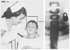 Nurse and X-Ray Showing Lock - Magnet Magic. Schenectady, N.Y. - 1953 Old Photo