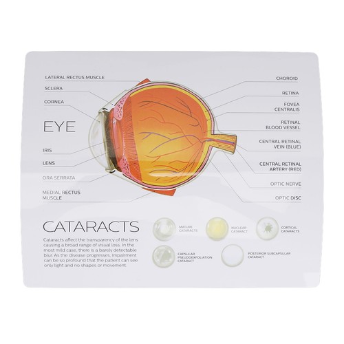 Augenmodell Modell Menschliches Auge Anatomie Lehrmodell Auge Anatomie Modell. - Bild 10 von 10