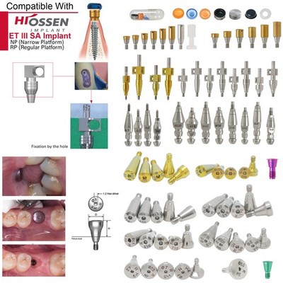 US Dental Locator Abutments Healing Impression Coping for Hiossen ET Osstem TS