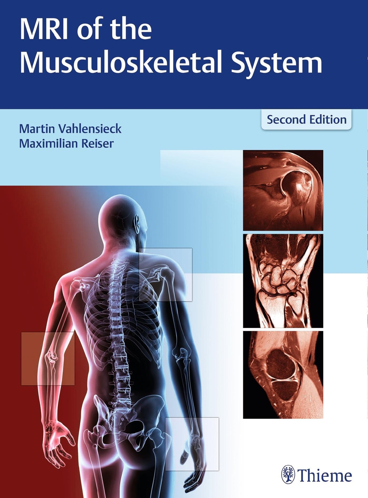 Thumbnail - Mri Of The Musculoskeletal System | Martin Vahlensieck (u. A.) | Buch