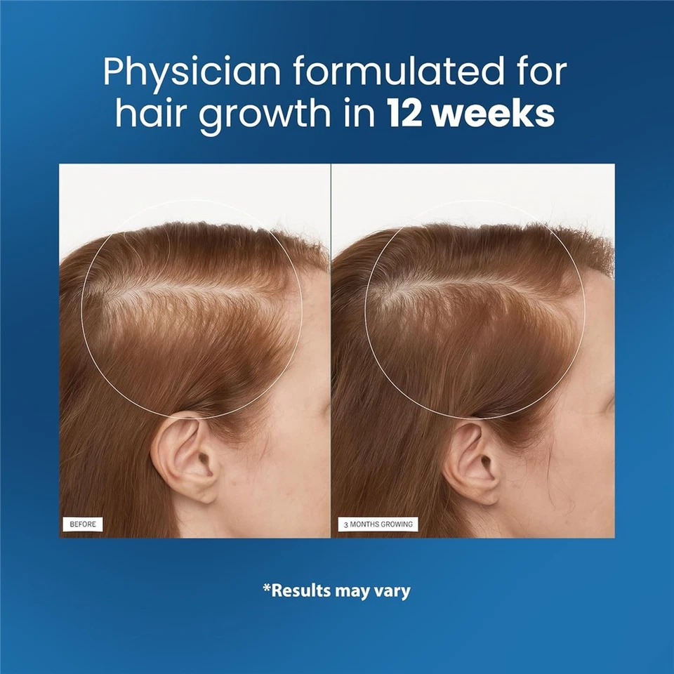 Be Bodywise Hair Growth Serum Roll On - 3% Rosemary, 3% Redensyl & 2% - 25ml - Image 4 of 4
