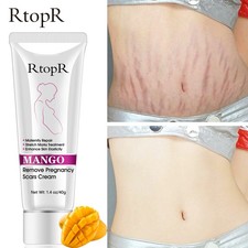 contractubex for stretch marks