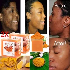 2Pc Turmeric Soap for Face&Body,Skin Brightening Anti-Acne Dark Spots Lightening