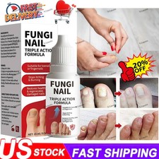 Fungi-Nail Anti-Fungal Liquid Solution Kills Fungus That Can Lead To Nail
