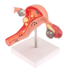 Uterus Model Clear Base Educational Aid for Classroom, Medical Training