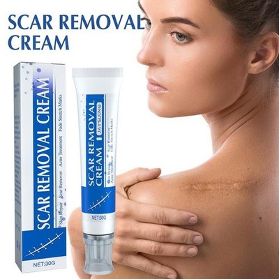 SCAR REMOVAL CREAM Skin Repair Scar|Remover Fade Stretch-MarkAcne Treatment