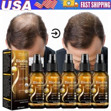 Biotin Hair Growth Spray Anti Hair Loss Fast Regrowth Scalp Treatment Serum US