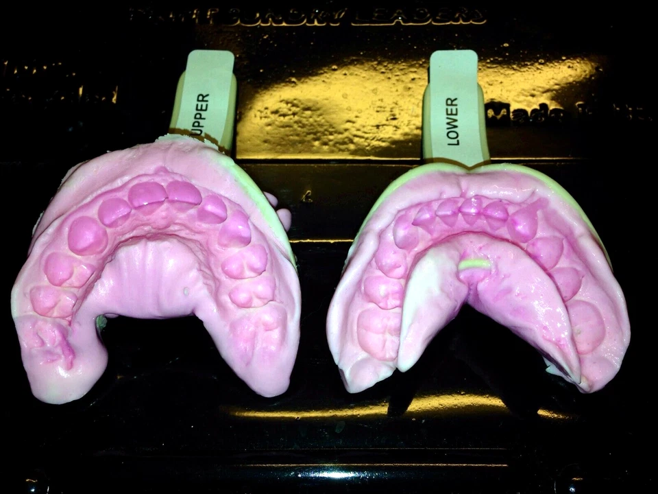 Kit de impresión de moldeo de dientes - Recomendado para ser utilizado por nuestros clientes actuales Foto 3 de 4