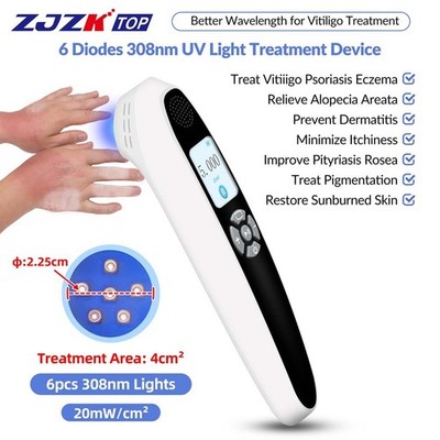 308nm UV Light Therapy Ultraviolet Lamp for Hands Face Arm Feet Skin Disorder