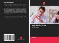 Rohit S. | Peri-Implantite | Taschenbuch | Portugiesisch (2021)