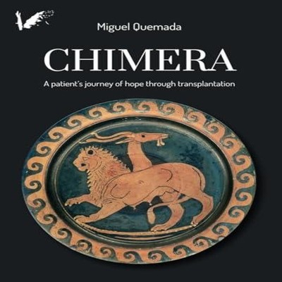 Chimera. A patient's journey of hope through transplantation Migu