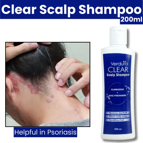 Clear Scalp Shampoo 200ml - Psoriasis Scalp & Dandruff Treatment